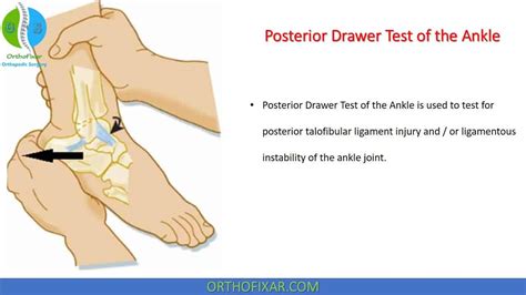 ankle ligament tear test|ankle special tests for ligaments.